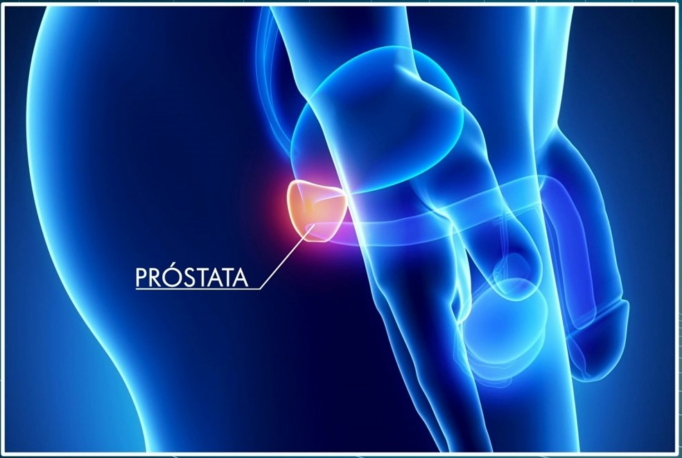 A próstata é uma pequena glândula localizada entre a bexiga e a pélvis do homem — Foto: Reprodução/TV Tapajós