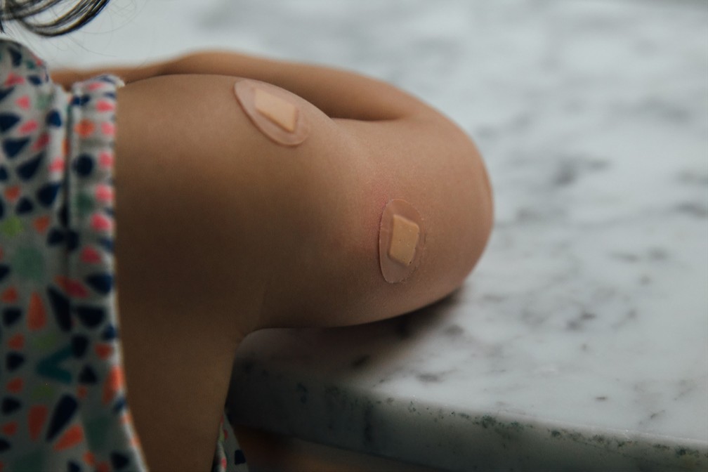 Marca de vacina em criança — Foto: Unsplash/Divulgação