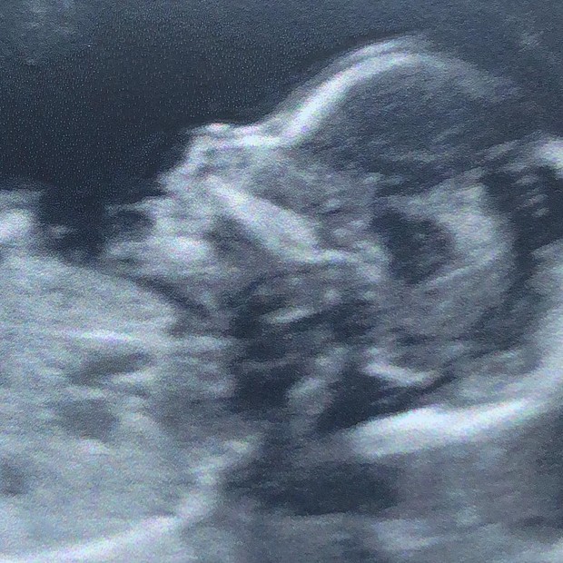 Thaeme anuncia nova gravidez (Foto: Reprodução/Instagram)