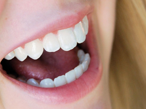 Nem todos conseguem ter dentes naturalmente brancos (Foto: Freeimages/Julia Freeman-Woolpert)
