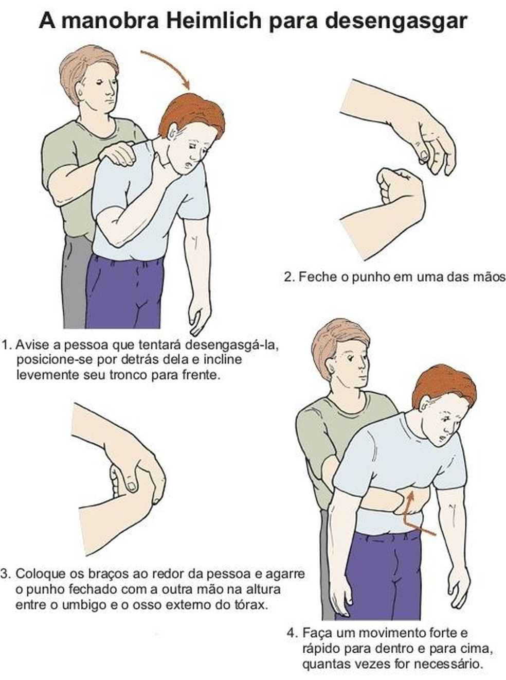 Manobra de Heimlich — Foto: Reprodução