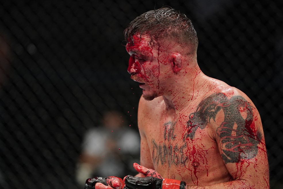 Darren Elkins terminou a luta muito ensanguentado — Foto: Getty Images