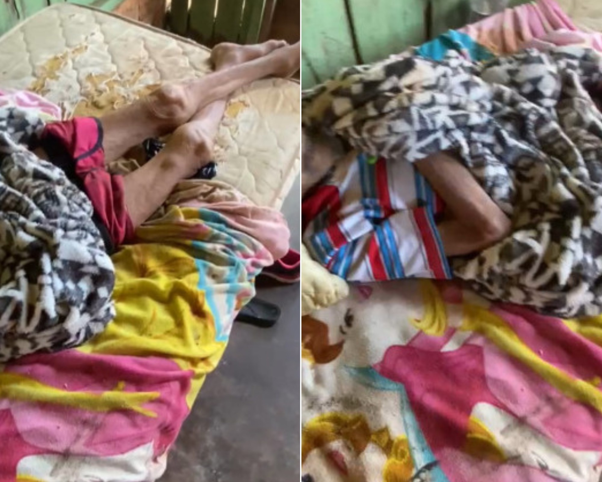 Idoso de 92 anos com corpo ‘tomado por formigas’ é resgatado em situação de abandono em RR