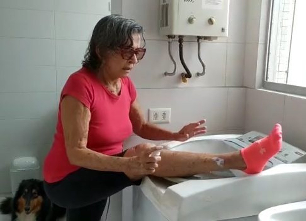 Betty Faria ergueu a perna para tratar de machucado (Foto: Reprodução/Instagram)
