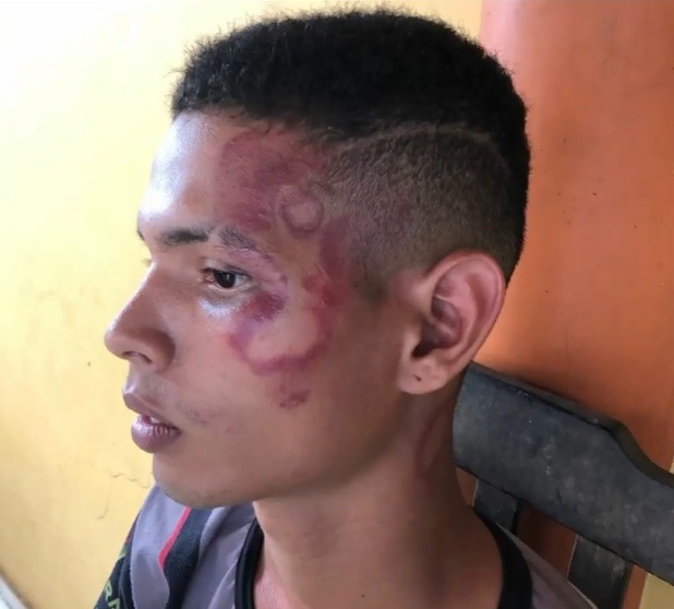 Suspeito de roubo, jovem é torturado e agredido por PMs à chineladas em Vargem Grande, no MA