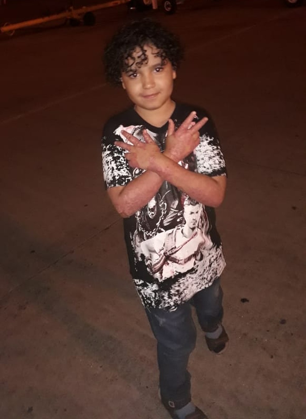Enzo Gomes foi diagnosticado com uma doença autoimune — Foto: Lucilene Ezequiel/Arquivo pessoal