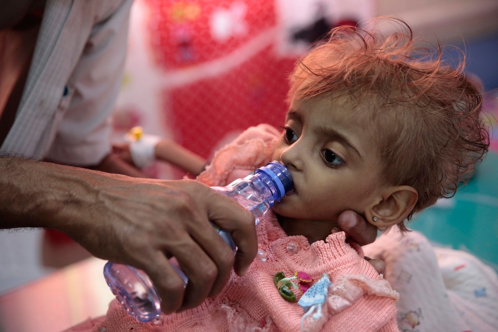Pai dÃ¡ Ã¡gua para filha desnutrida em um centro de alimentaÃ§Ã£o em um hospital em Hodeida, no IÃªmen, em 27 de setembro  â€” Foto: Hani Mohammed/AP