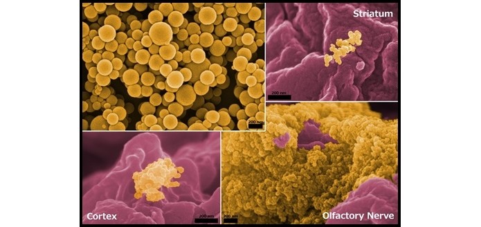 Nanopartículas de gelatina no cérebro (Foto: Divulgação/NNCO)