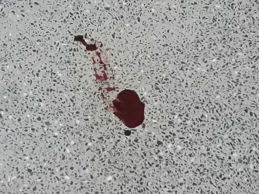 Entregador foi baleado durante o confronto — Foto: TVCA/Reprodução