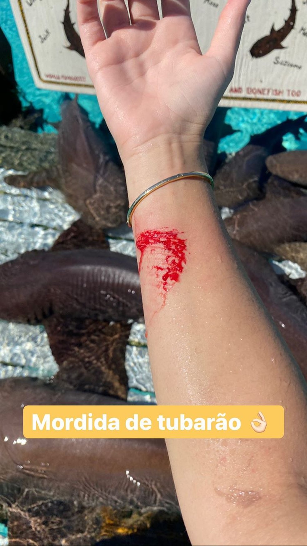 Influencer Ana Bruna Avila é mordida por tubarão nas Bahamas — Foto: Reprodução/Instagram