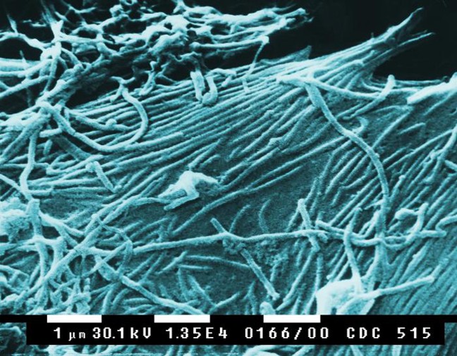 Vírus Ebola. Chave para a cura do vírus pode estar no tratamento com anticorpos. (Foto: Wikipedia Commons)