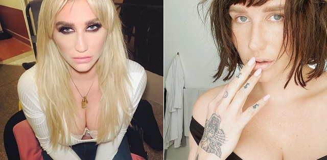 Kesha: antes e depois (Foto: instagram/reprodução)