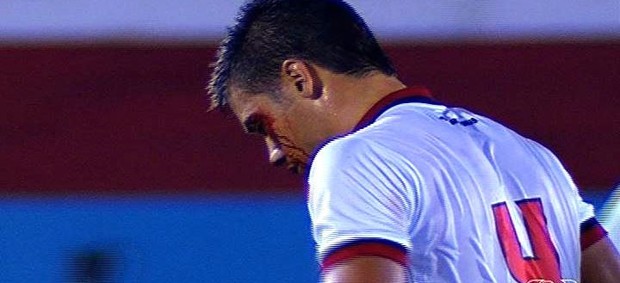 Diego Giaretta zagueiro Atlético-GO (Foto: Reprodução/TV Anhanguera)
