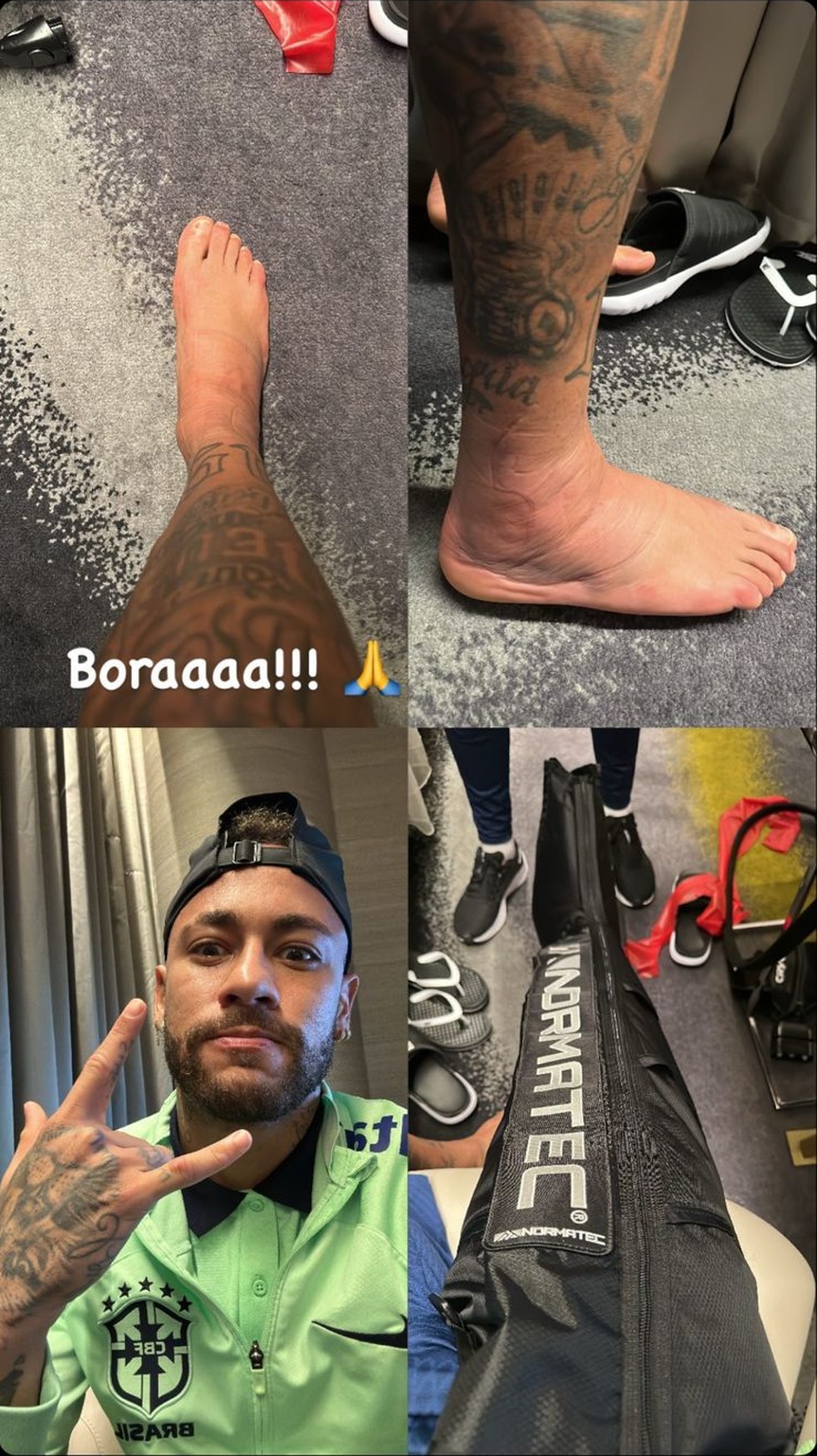 Neymar em tratamento de lesão no tornozelo direito — Foto: Reprodução/Instagram