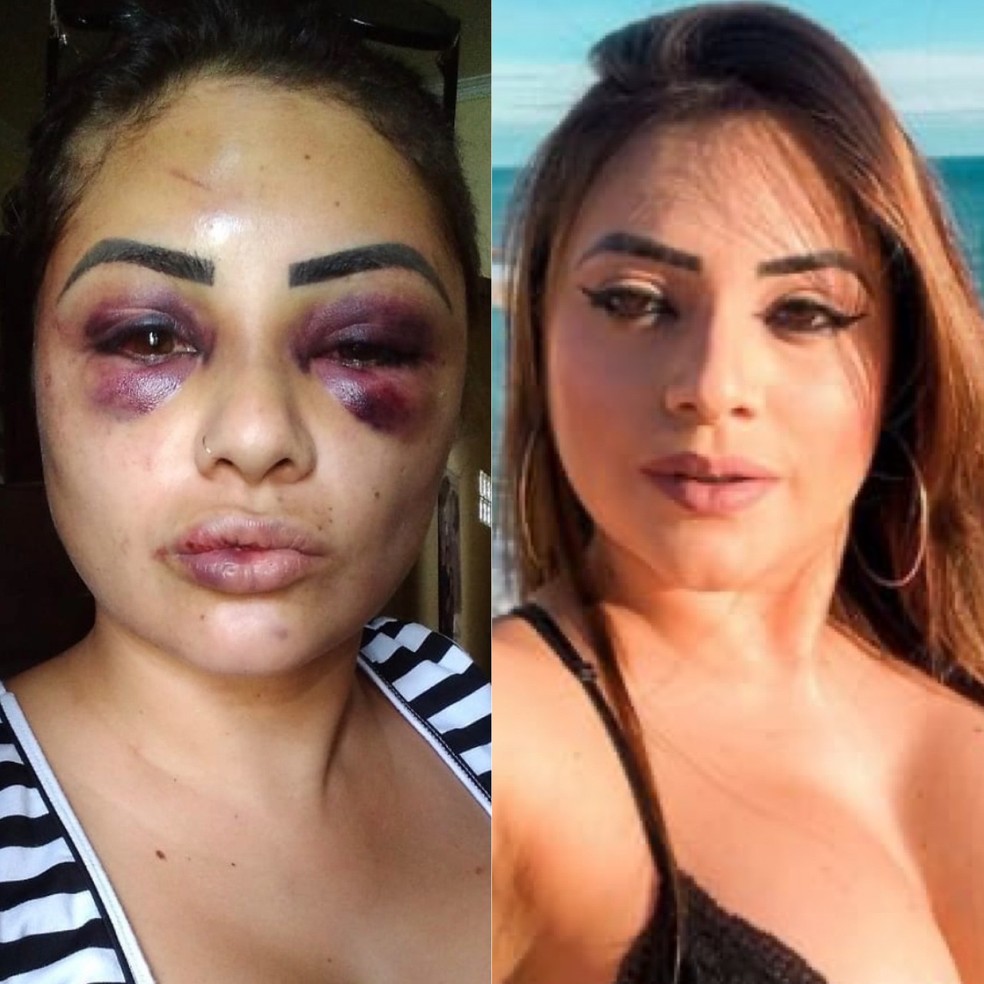 Influencer vítima de espancamento grava vídeo com relato da agressão:  'tentaram furar meus olhos' | Vale do Paraíba e Região | G1