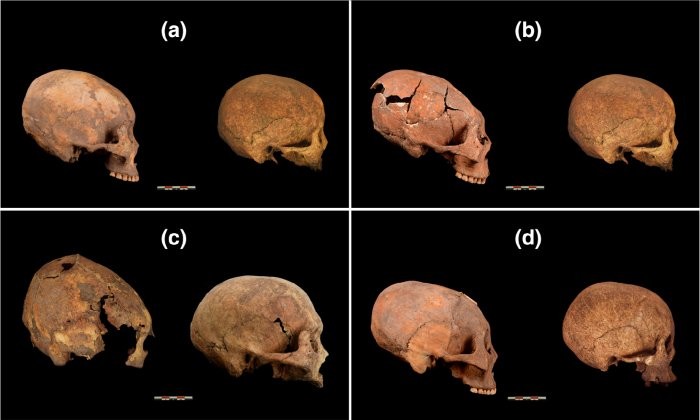 Quatro crânios adultos intencionalmente modificados (à esquerda) comparados a crânios não modificados  (Foto: Zhang et al., American Journal of Physical Anthropology, 2019)