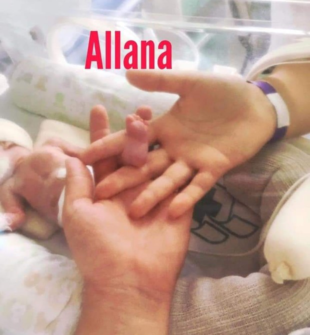 Allana nasceu com 26 semanas e pouco mais de 400 gramas (Foto: Arquivo pessoal)