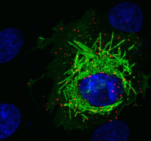 Estudo revela como o Sars-CoV-2 manipula as células para se replicar
