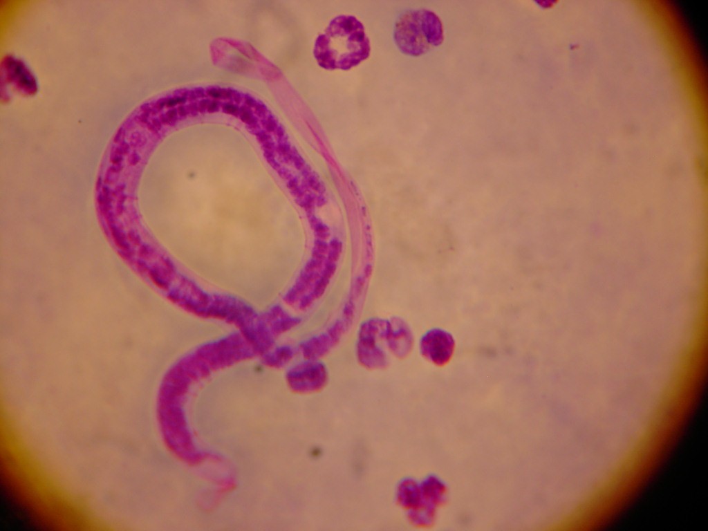 Brugia malayi, um dos parasitas transmitidos por picada de mosquito e causadores da elefantíase (filariose linfática) (Foto: Michael Wunderli/Wikimedia Commons)