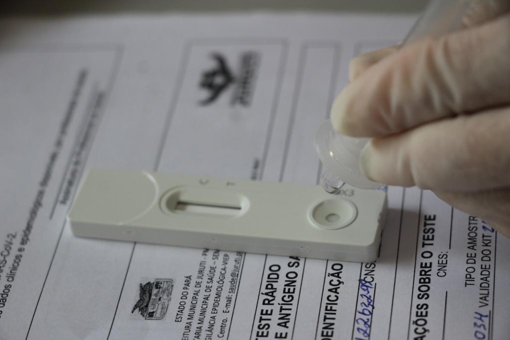Covid-19: veja boletim da Prefeitura de Uberlândia de 19/03/2022; pelo 3º dia seguido nenhum óbito é registrado