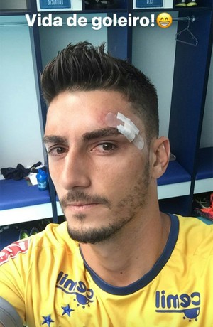 Com pontos no rosto, Rafael posta foto e tranquiliza torcida: Vida de goleiro