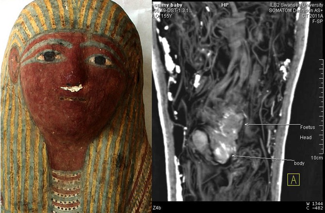 Sarcófago e feto egípcios. (Foto: Reprodução/Carolyn Graves-Brown/Swansea University’s Egypt Center)